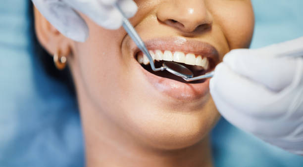 Best Emergency Dentist for Lost Fillings or Crowns in Collings Lakes, NJ
